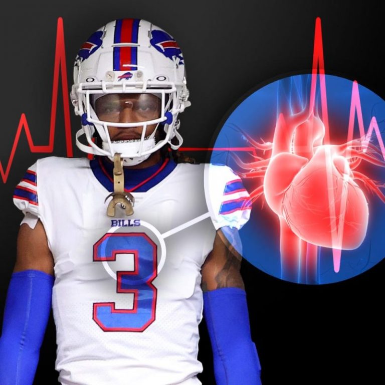 CPR and electric shock: What happened after Damar Hamlin’s collapse