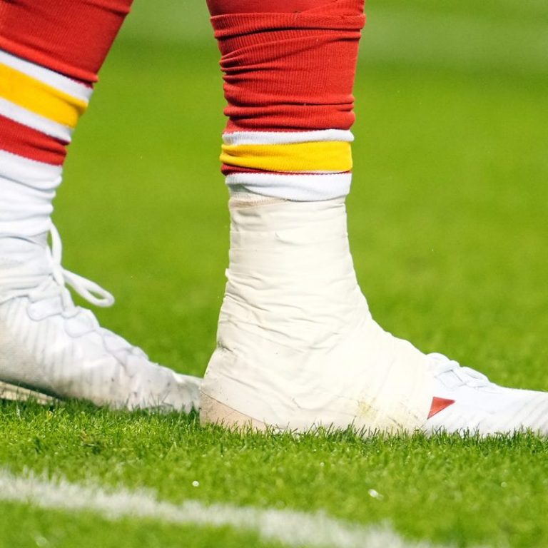 Chiefs QB Patrick Mahomes suffered a high ankle sprain. What is it?