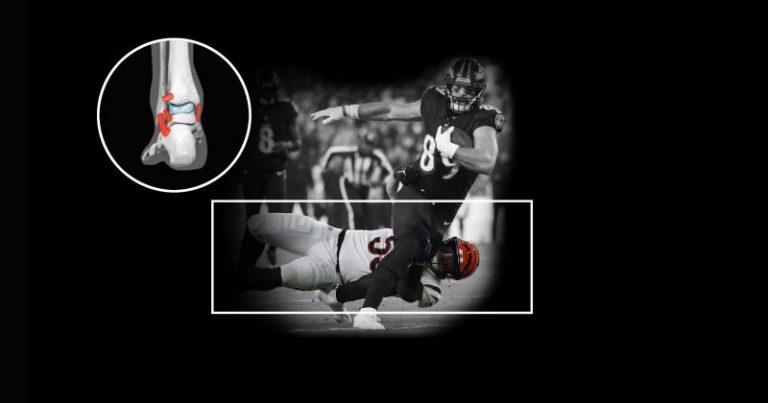 Graphics explain hip-drop tackle, why some in the NFL want it banned